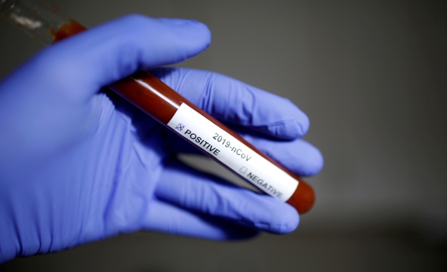 UMRECİLER DE VİRÜS ŞÜPHESİ